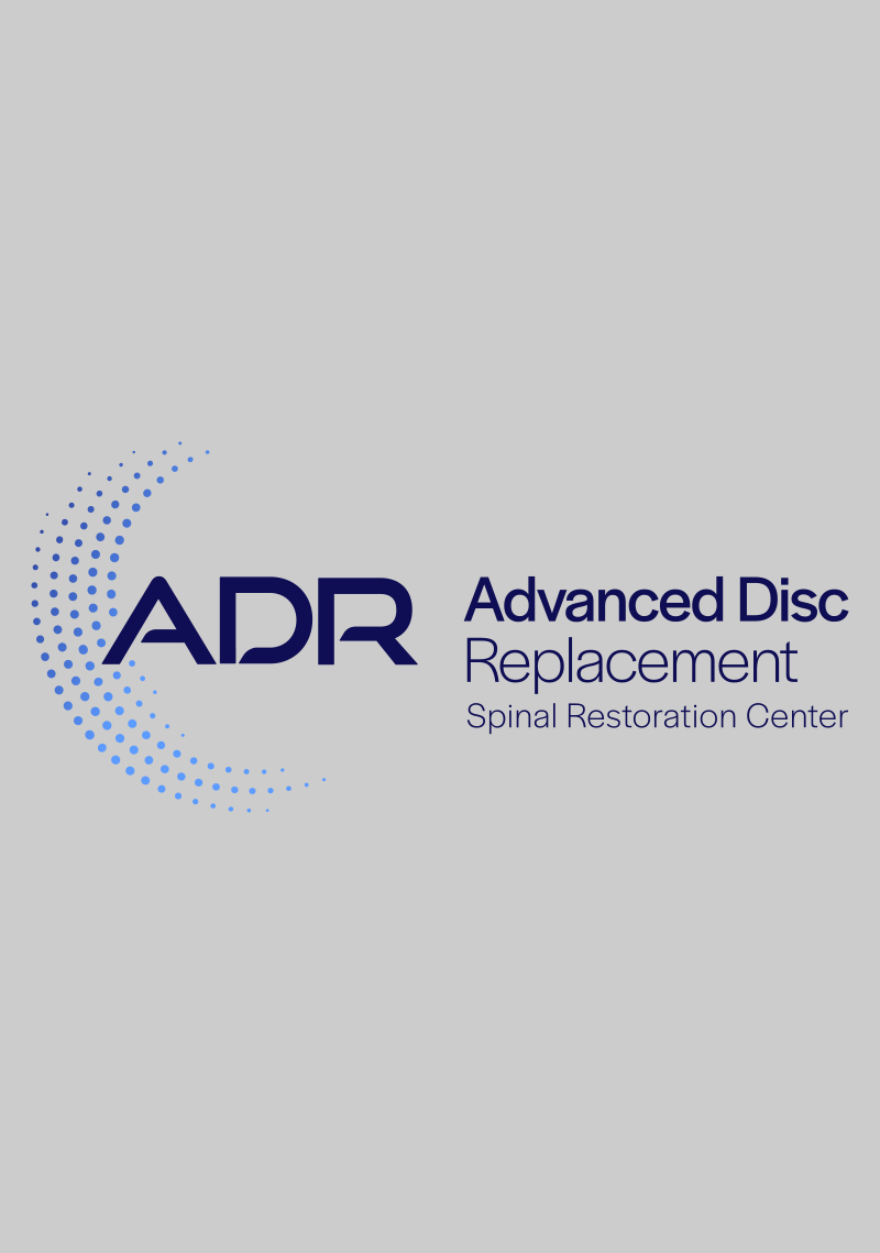 Single and Multilevel Lumbar Total Disc Replacement Adjacent to L5-S1 ALIF (Lumbar Hybrid): 6 Years of Follow-up