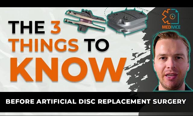 3 Things To Know Before Considering an Artificial Disc Replacement