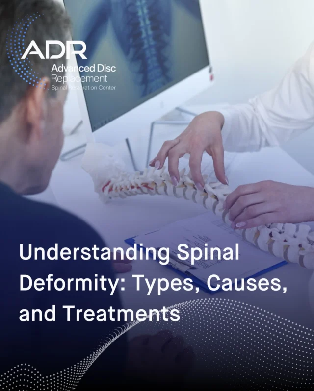 Spinal deformities often start with subtle signs that are easy to dismiss. 

Chronic back stiffness, uneven shoulders or hips, visible spinal asymmetry, and numbness or tingling from nerve compression are all early indicators that shouldn't be ignored. The key is recognizing these symptoms before deformities progress and become more complex to treat. 

Visit the link in our bio to learn how to identify the warning signs of various deformities and discover the full range of treatment options.
.
.
.
.
#ADRSpine #DrToddLanman #LanmanSpinalNeurosurgery #artificialdiscreplacement #spinehealth #discreplacement #lumbardiscreplacement #neckpain #backpainrelief #neurosurgeon