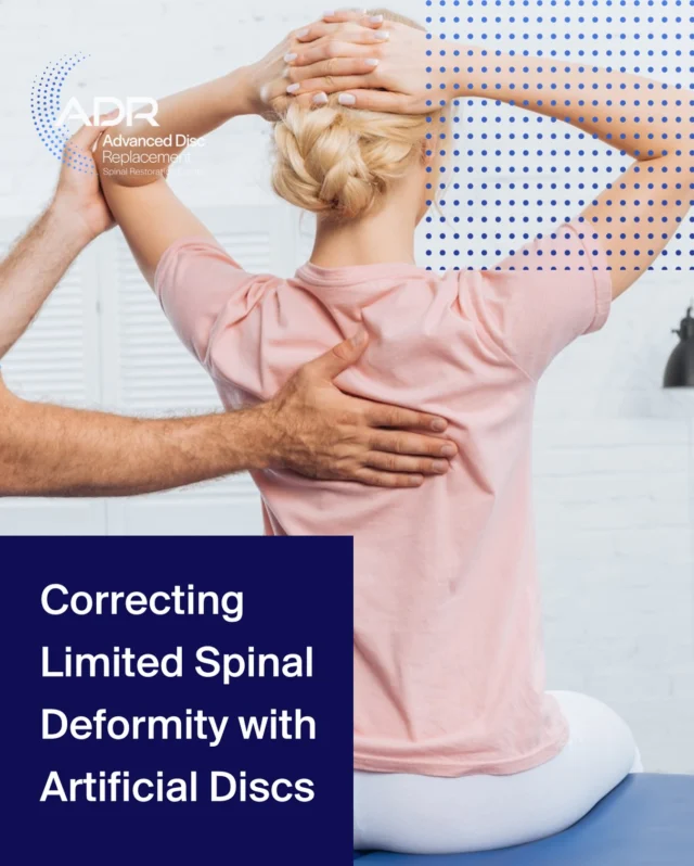 Even minor spinal deformities can significantly impact posture, mobility, and quality of life.

Patients suffering from specific types of spinal misalignment, like degenerative scoliosis, kyphosis (rounding of the spine), or loss of disc height or alignment, can take a modern, minimally invasive path to a more active and pain-free life through artificial disc replacement.

ADR can help re-establish natural disc spacing and curvature, improve alignment, and protect adjacent segments while preserving spinal motion.

Find ADR candidate qualifications at the link in bio and schedule a consultation with Dr. Lanman or an ADR Top Doctor in Arthroplasty to determine whether this treatment is right for you.
.
.
.
.
.
#ADRSpine #DrToddLanman #LanmanSpinalNeurosurgery #artificialdiscreplacement #spinehealth #discreplacement #lumbardiscreplacement #neckpain #backpainrelief #neurosurgeon