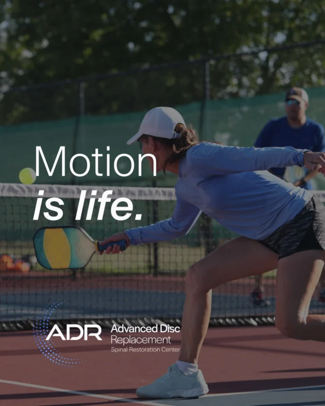 Motion is life! Every bend, every twist, and every turn of your head recruits your spine and its natural movement.

Fusion is a compromise. It limits that motion for the rest of your life, while ADR preserves it.

The choice is yours: live with limitations or live limitlessly. Your spine is worth more than “good enough.” 

The question is, what is it worth to you?
.
.
.
.
#ADRSpine #DrToddLanman #LanmanSpinalNeurosurgery #artificialdiscreplacement #spinehealth #discreplacement #lumbardiscreplacement #neckpain #backpainrelief #neurosurgeon